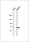 Ribophorin (RPN1) Antibody (C-term)